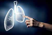 6 điều cần biết về sinh thiết phổi